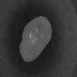 Medical imaging segmentation overlay 1