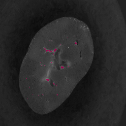 Medical imaging segmentation overlay 2
