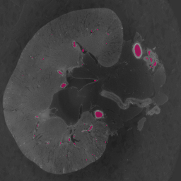Medical imaging segmentation overlay 4