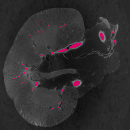 Medical imaging segmentation overlay 6