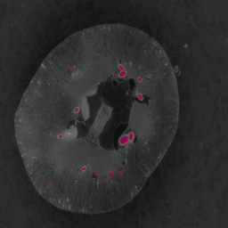 Medical imaging segmentation overlay 5