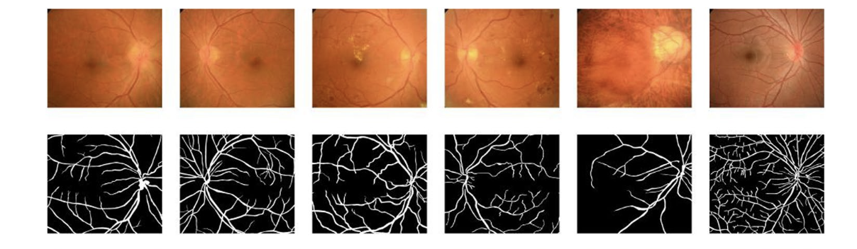 Computer Vision for Medical Image Segmentation